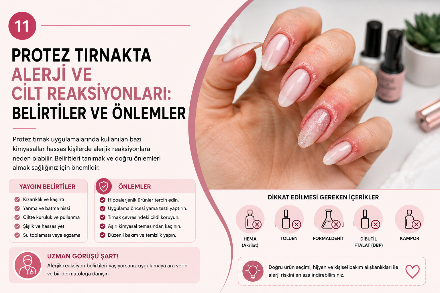 Protez Tırnak Alerjisi ve Cilt Reaksiyonları: Belirtiler ve Önlemler